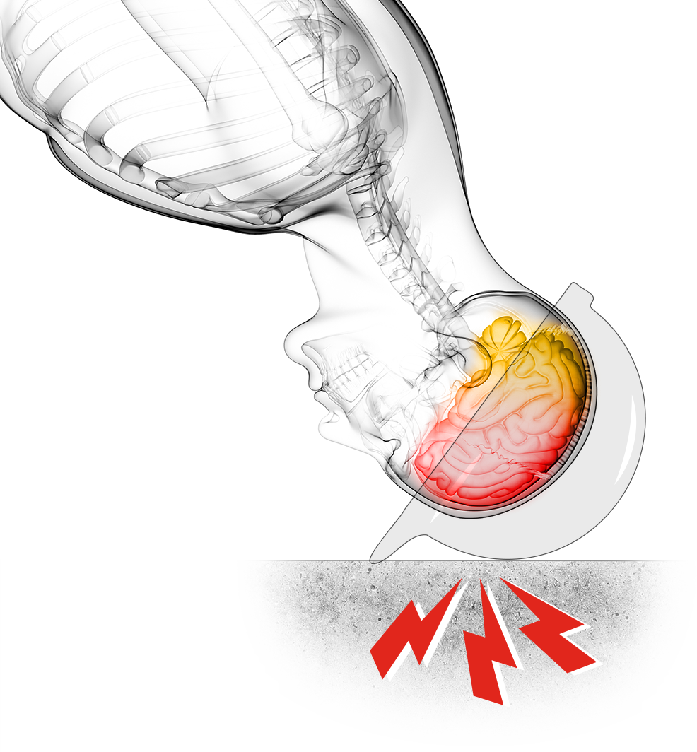 head injury image